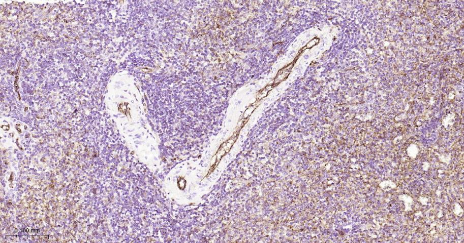 血小板内皮细胞黏附分子1重组兔单抗