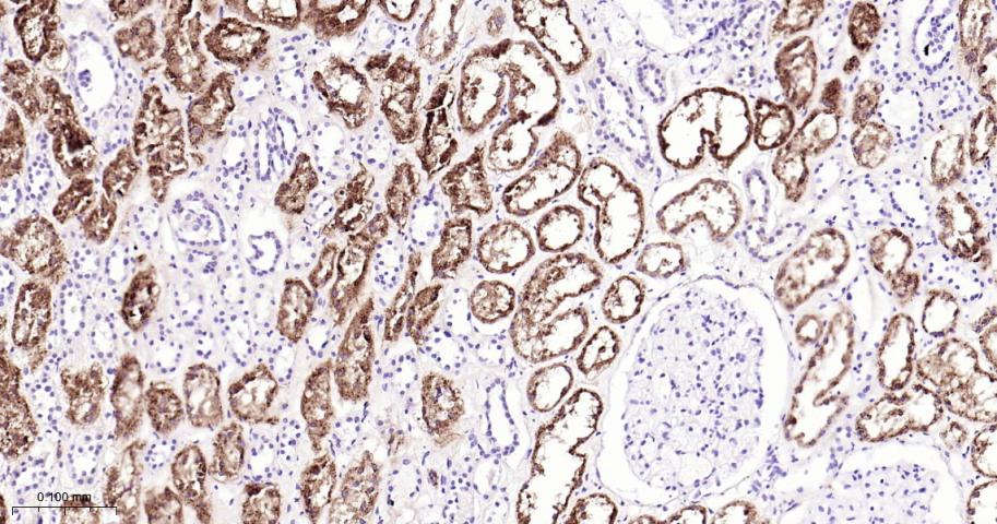 天冬氨酸蛋白酶ASP4重组兔单抗