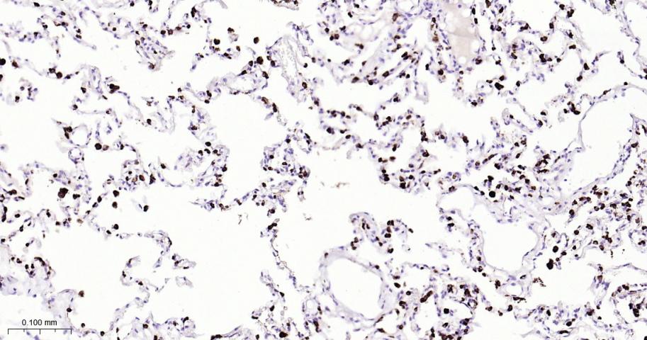 天冬氨酸蛋白酶ASP4重组兔单抗