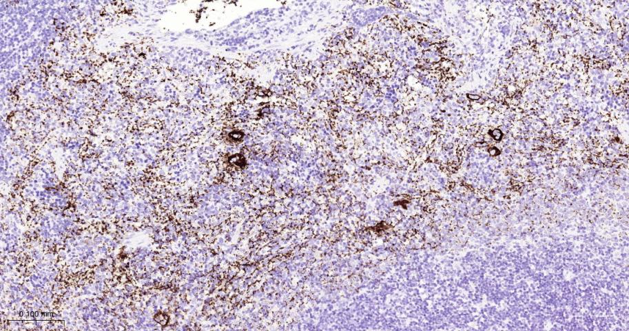 血小板糖蛋白GPIb（CD42b）重组兔单抗
