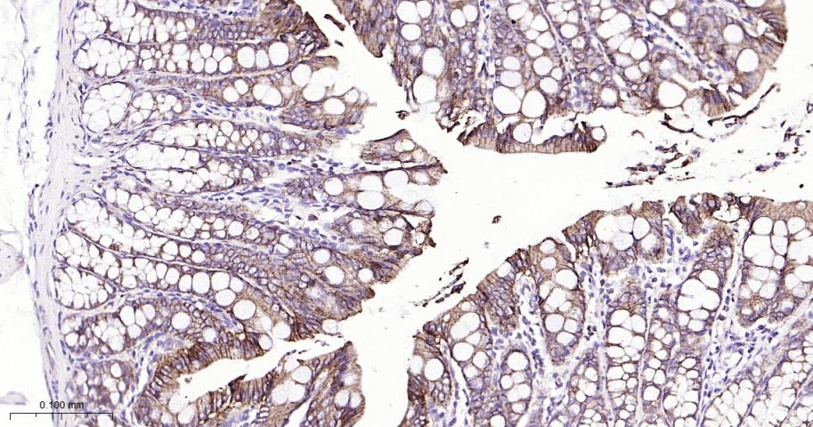 连环蛋白delta-1重组兔单抗