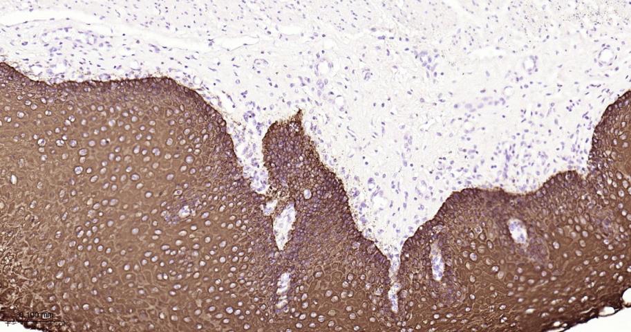 细胞角蛋白16重组兔单抗