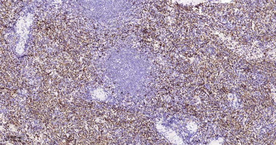 血小板糖蛋白GPIb（CD42b）重组兔单抗