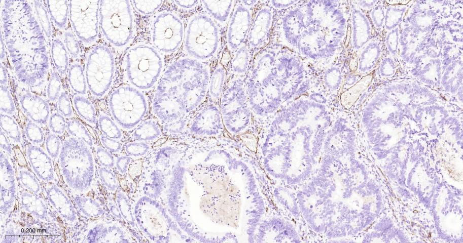 血小板内皮细胞黏附分子1重组兔单抗