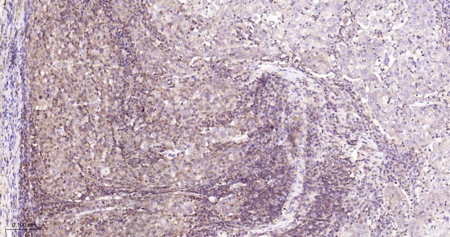 磷酸变位酶1重组兔单抗