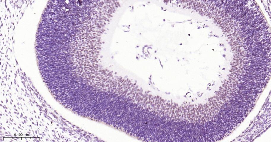 活化转录因子4重组兔单抗