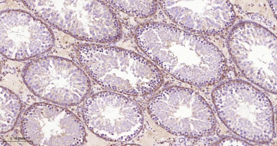 磷酸变位酶1重组兔单抗