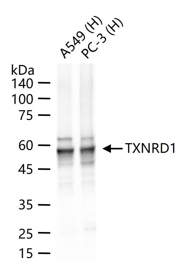 硫氧环蛋白还原酶1重组兔单抗
