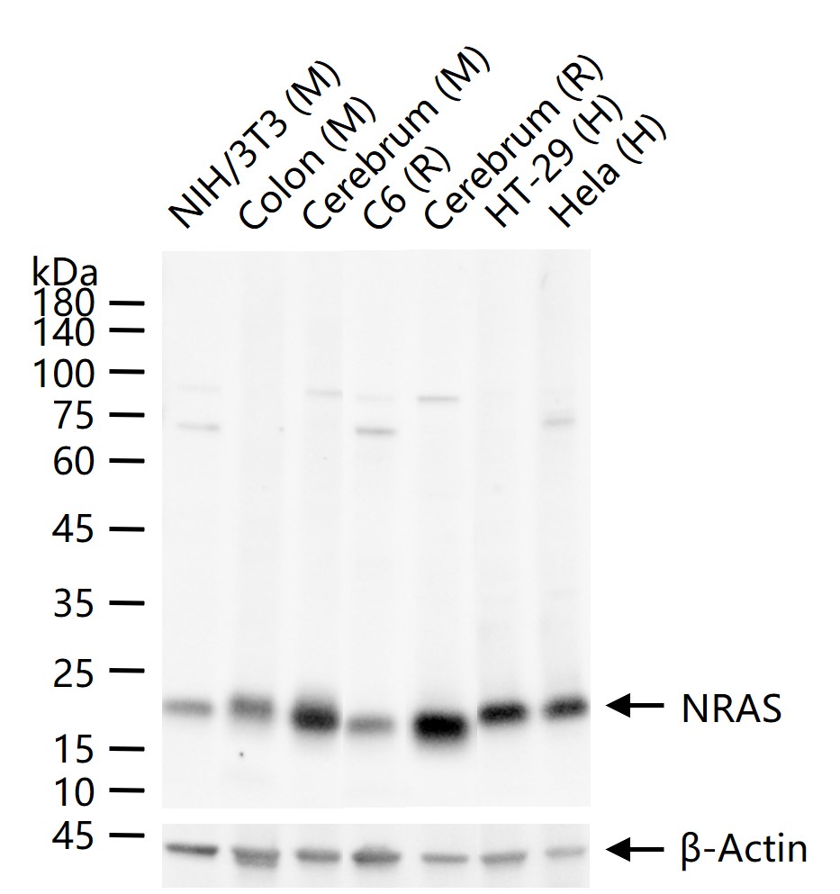 原癌基因N-Ras重组兔单抗