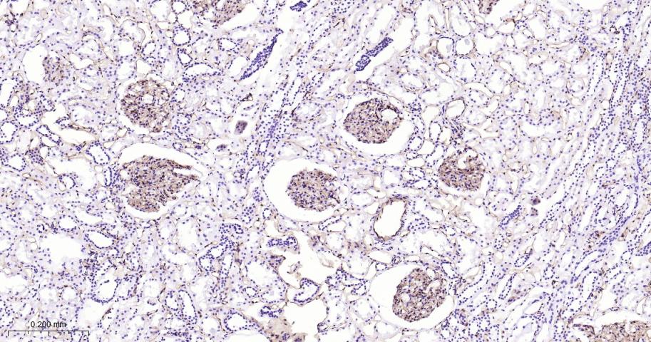 血小板内皮细胞黏附分子1重组兔单抗