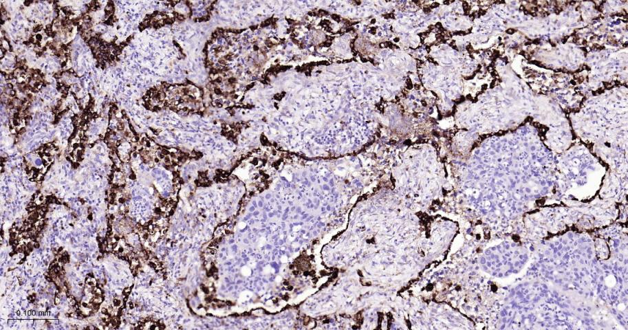 天冬氨酸蛋白酶ASP4重组兔单抗