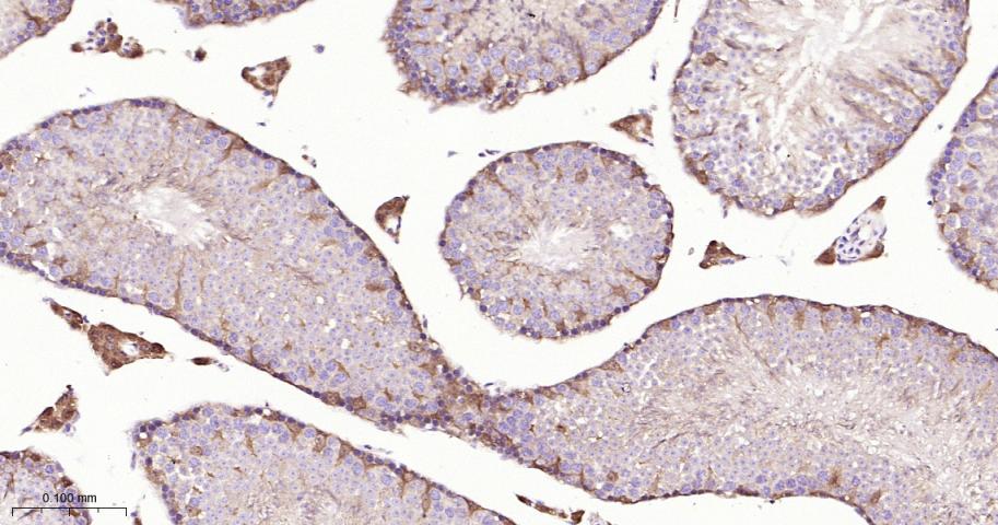 磷酸变位酶1重组兔单抗