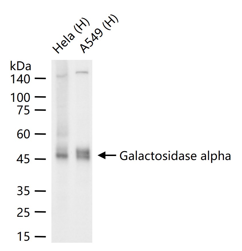 α-半乳糖苷酶重组兔单抗