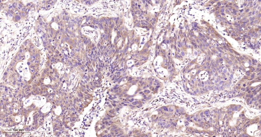 磷酸变位酶1重组兔单抗