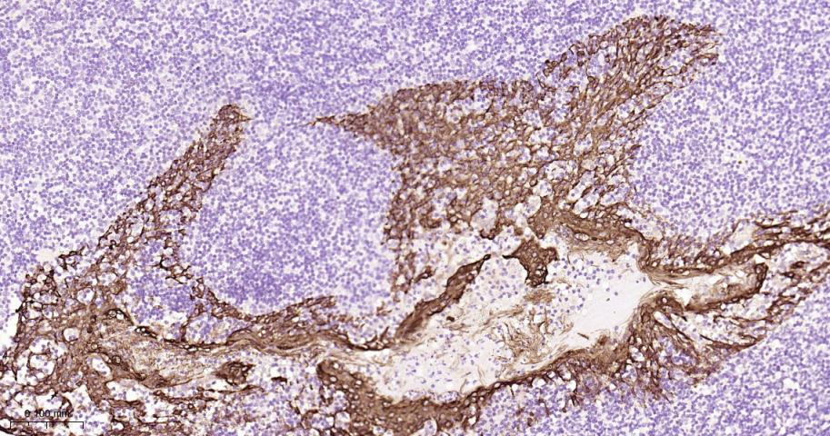 细胞角蛋白16重组兔单抗