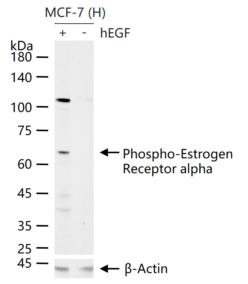 phospho-Estrogen Receptor alpha (Ser104 + Ser106) Rabbit pAb (一抗) - WB,Flow-Cyt,ICC/IF | Bioss