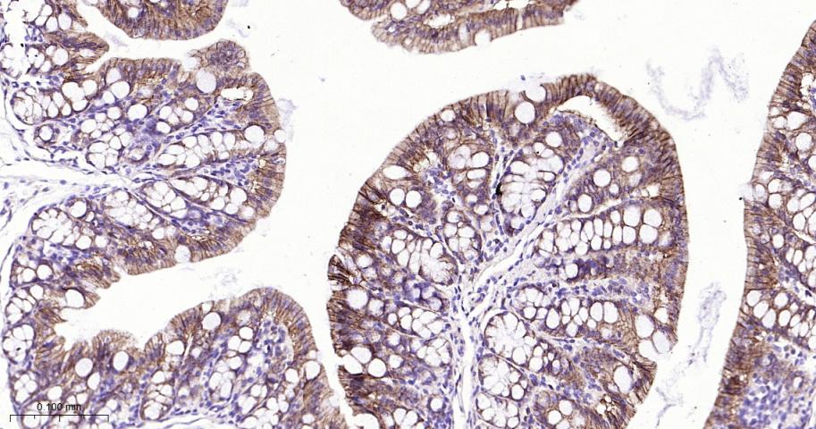 连环蛋白delta-1重组兔单抗