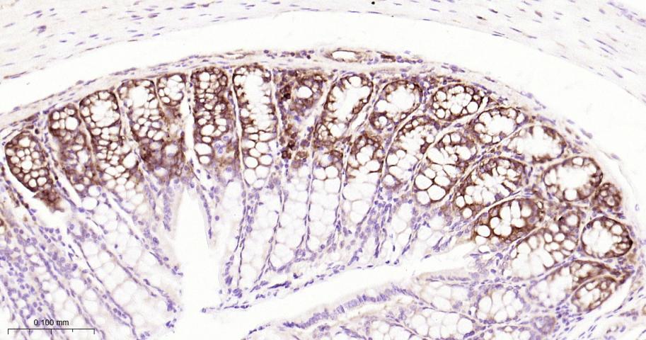磷酸化真核启动因子2α抗体