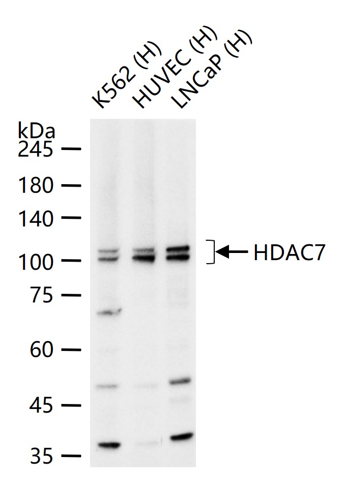 组蛋白去乙酰化酶7重组兔单抗