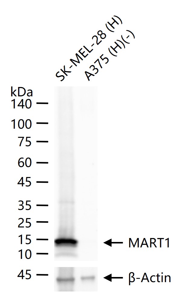 黑色素瘤相关抗原/黑色素-A重组兔单抗