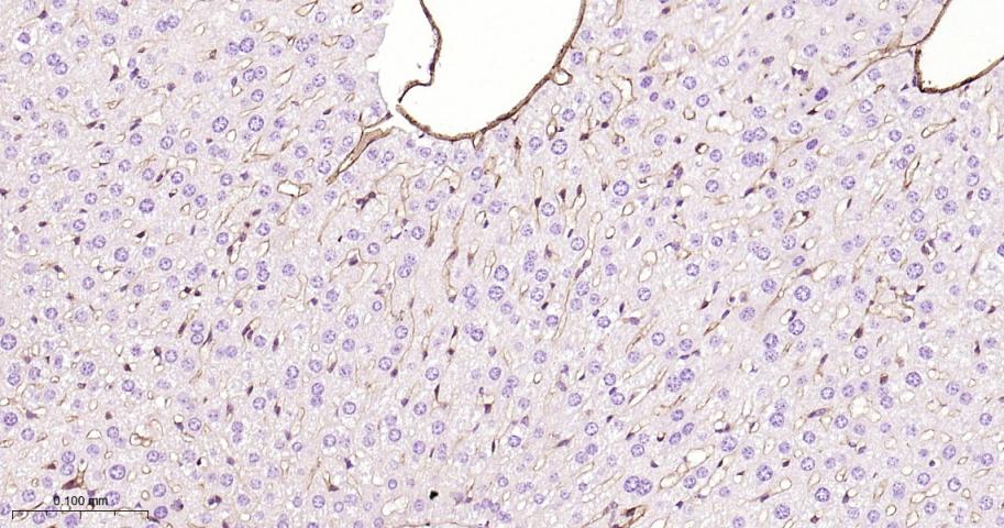 CD105 Rabbit pAb (一抗) - IHC-P,IHC-F,IF | Bioss
