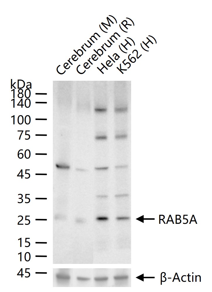 RAB5A Recombinant Rabbit mAb (一抗) - WB,IHC-P,IHC-F,IF,ICC/IF | Bioss
