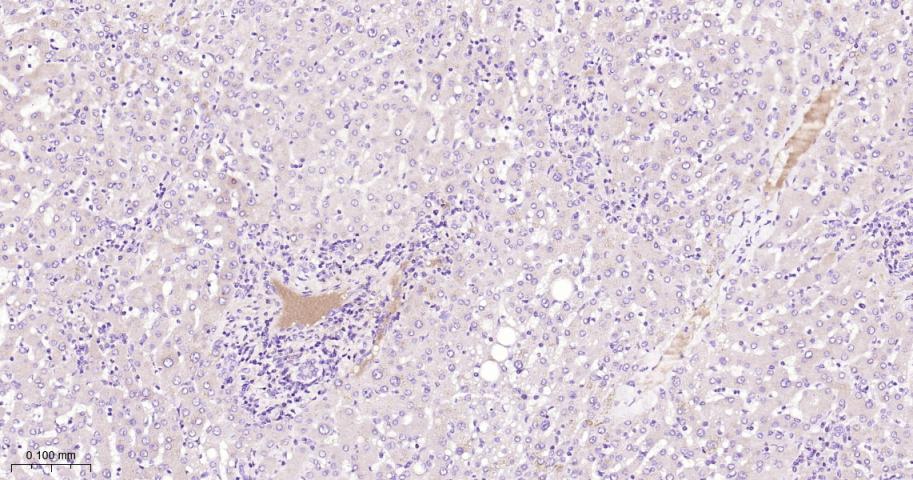 纤维蛋白肽A重组兔单抗