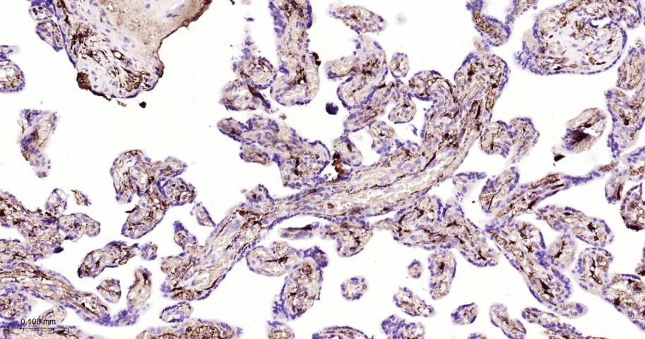 纤维蛋白肽A重组兔单抗