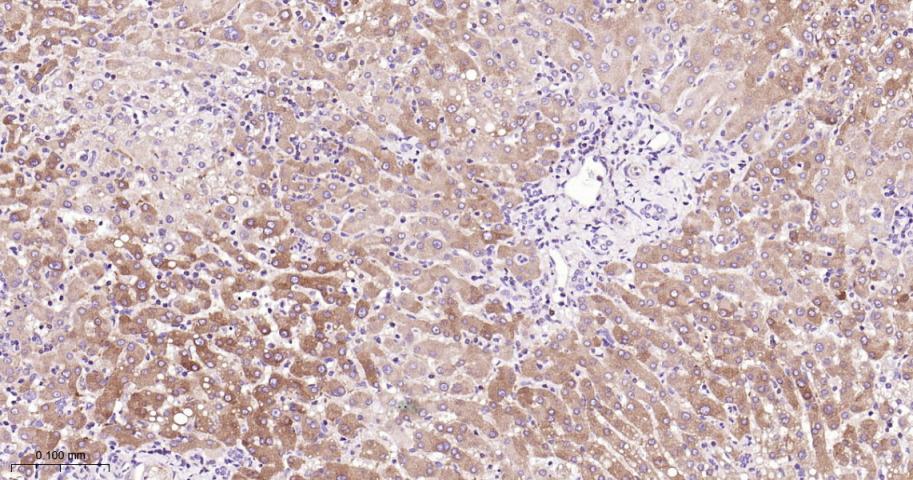 张力蛋白4重组兔单抗