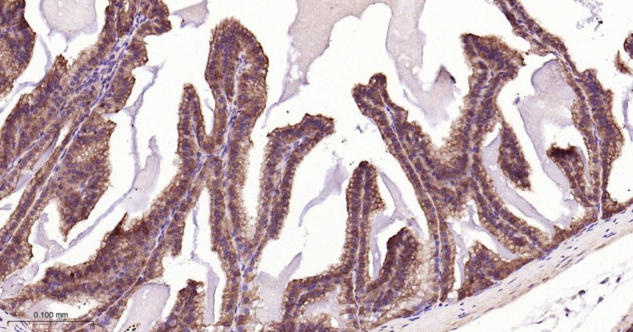 张力蛋白4重组兔单抗