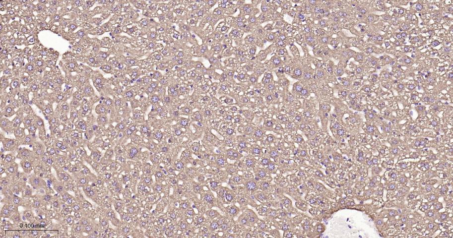 张力蛋白4重组兔单抗