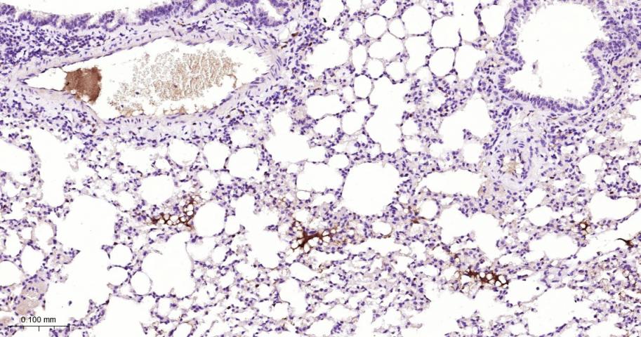 纤维蛋白肽A重组兔单抗