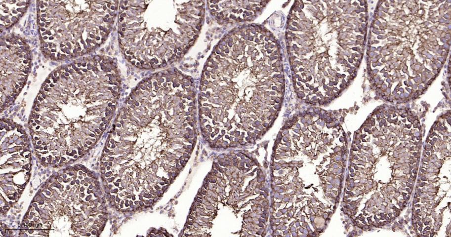热休克蛋白90β/HSP90 β 重组兔单抗