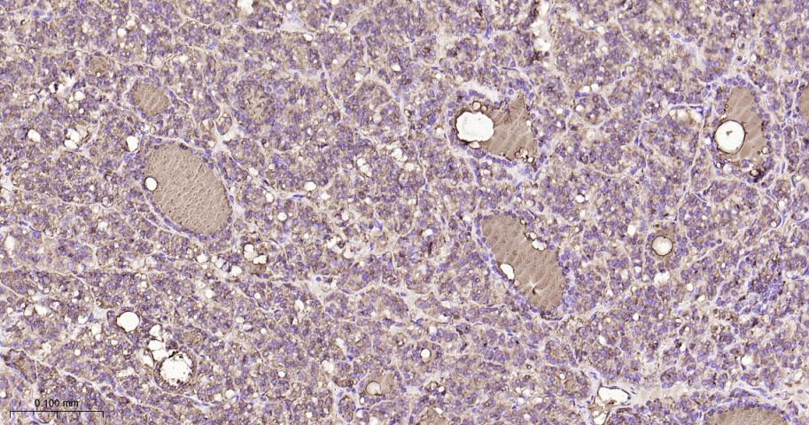 甲状腺球蛋白重组兔单抗