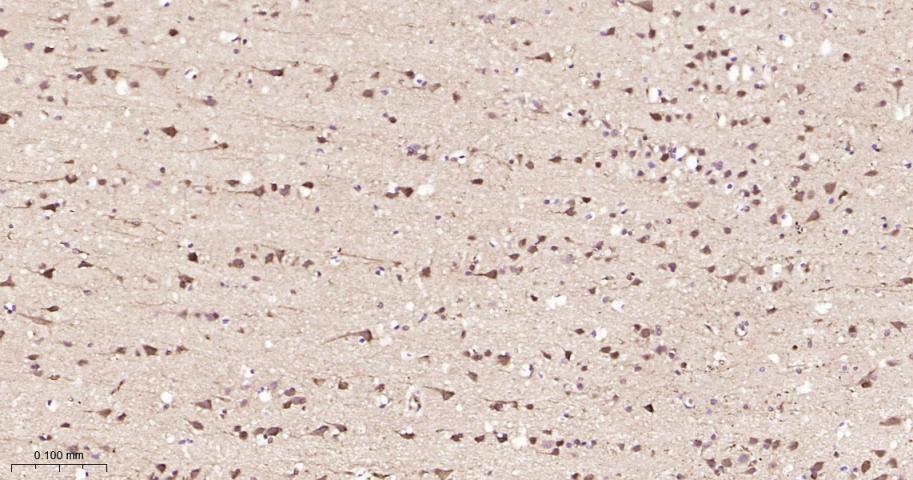 热休克蛋白90β/HSP90 β 重组兔单抗