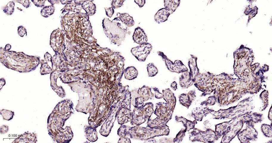张力蛋白4重组兔单抗