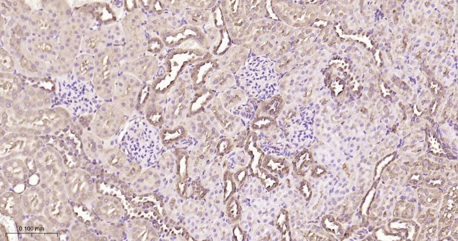 热休克蛋白90β/HSP90 β 重组兔单抗