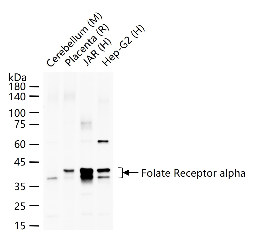 叶酸受体α/α-FR 重组兔单抗