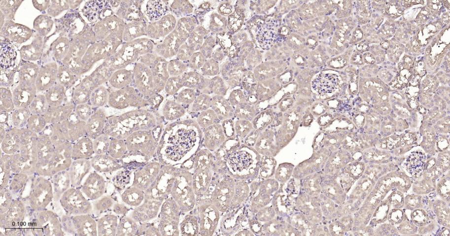 热休克蛋白90β/HSP90 β 重组兔单抗