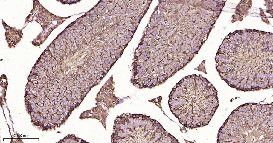 热休克蛋白90β/HSP90 β 重组兔单抗