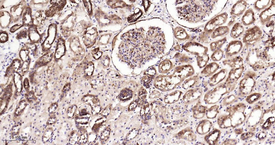 热休克蛋白90β/HSP90 β 重组兔单抗