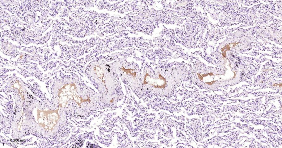 纤维蛋白肽A重组兔单抗