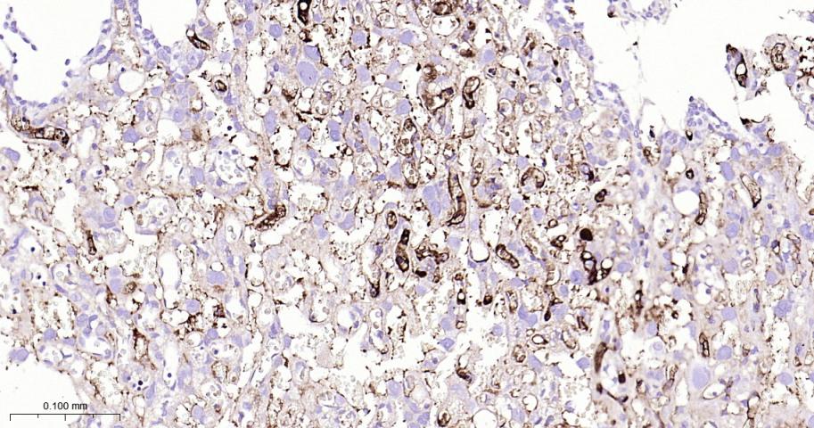 纤维蛋白肽A重组兔单抗