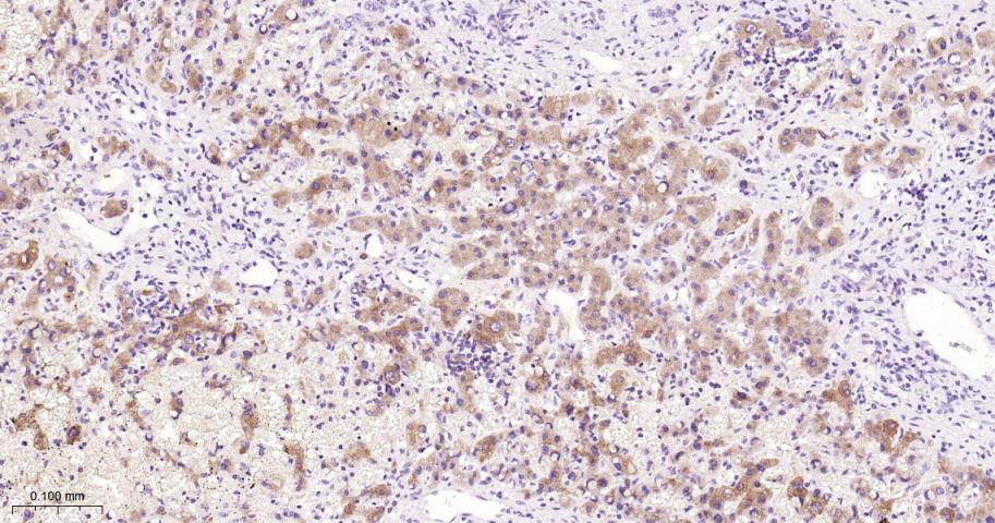 张力蛋白4重组兔单抗