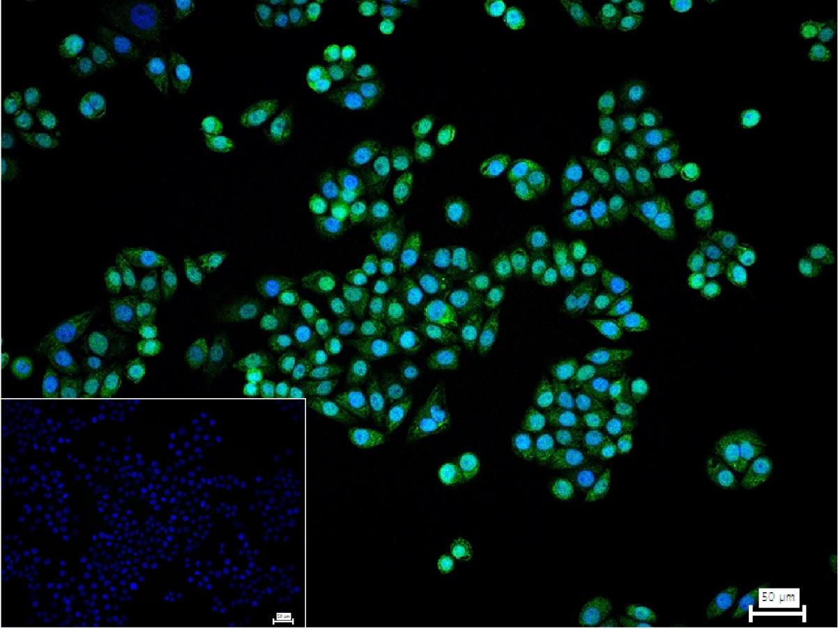 转录调节因子CEBP β重组兔单抗