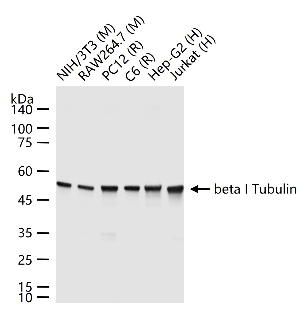 微管蛋白β1 tubulin(内参)重组兔单抗