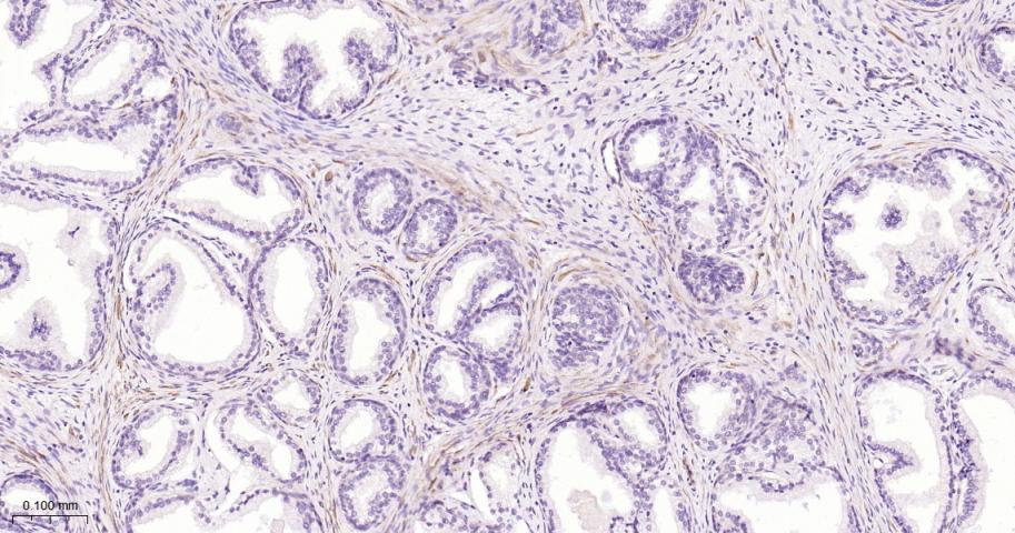 张力蛋白4重组兔单抗