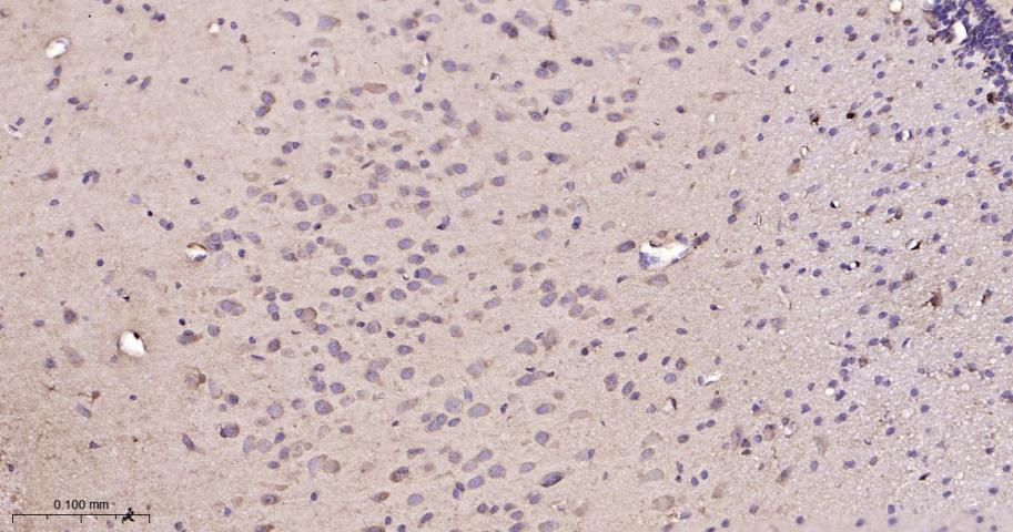 热休克蛋白90β/HSP90 β 重组兔单抗