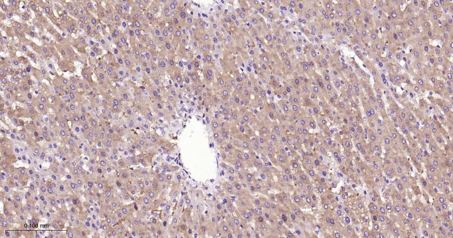 张力蛋白4重组兔单抗