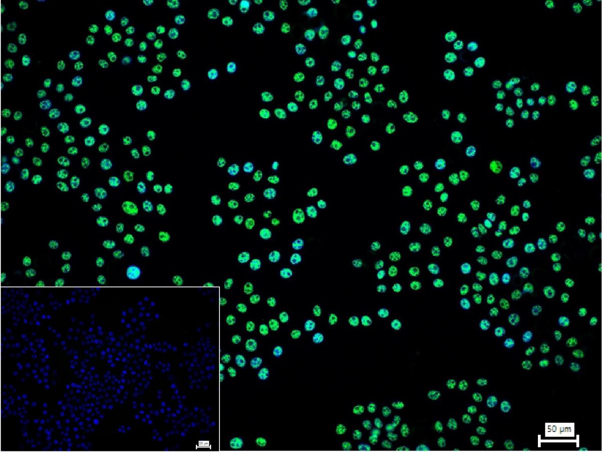 PRPF19重组兔单抗